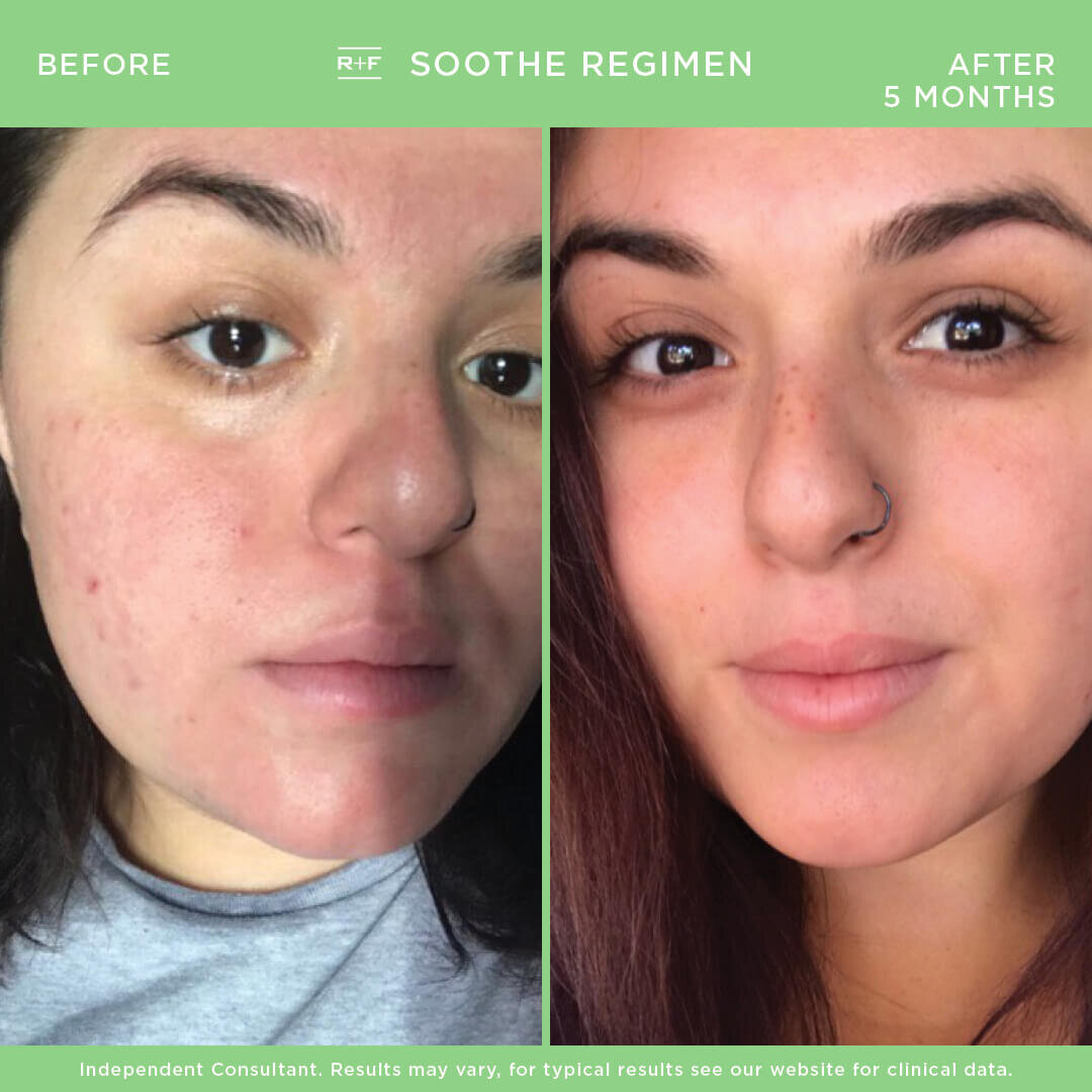 RODAN + FIELDS <br/>あの飛ぶように売れたまつ毛育毛美容液を提げて ...